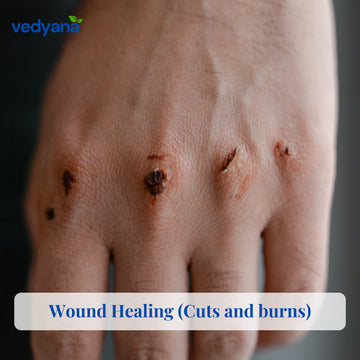 Vedyana Khadira Bark (Acacia catechu) | Khair Bark