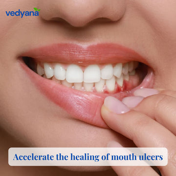 Vedyana Alum Powder (Potassium Aluminum Sulfate) | Fitkari Powder